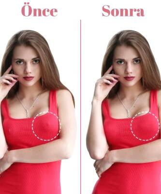 Göğüs Ucu Kapatıcı - 3